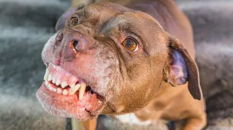 Świerzna. Trzy pitbulle dotkliwie pogryzły 26-letnią kobietę