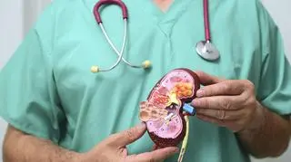 Światowy Dzień Raka Nerki. Na czym polega ten nowotwór i jak go rozpoznać?
