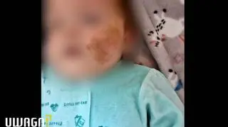 Niemowlę miało ślady pobicia. Matce wcześniej odebrano 6 dzieci. "W domu leciały noże"