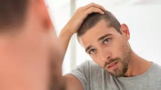 Łysienie zależy nie tylko od genów czy hormonów. Co przyczynia się do wypadania włosów u mężczyzn? 