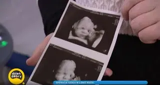 Jak operuje się dziecko w łonie matki? 