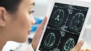 Czy hormonalna terapia zastępcza chroni przed Alzheimerem? Badacze doszli do ciekawych wniosków 
