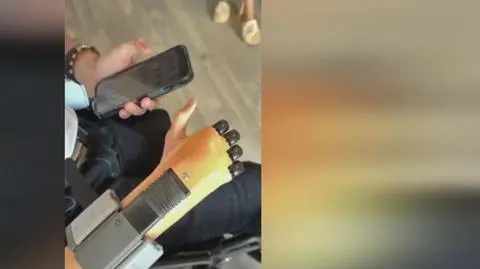 Uwaga! TVN. Dominik otarł się o śmierć. Dziś walczy o samodzielność z nowymi protezami