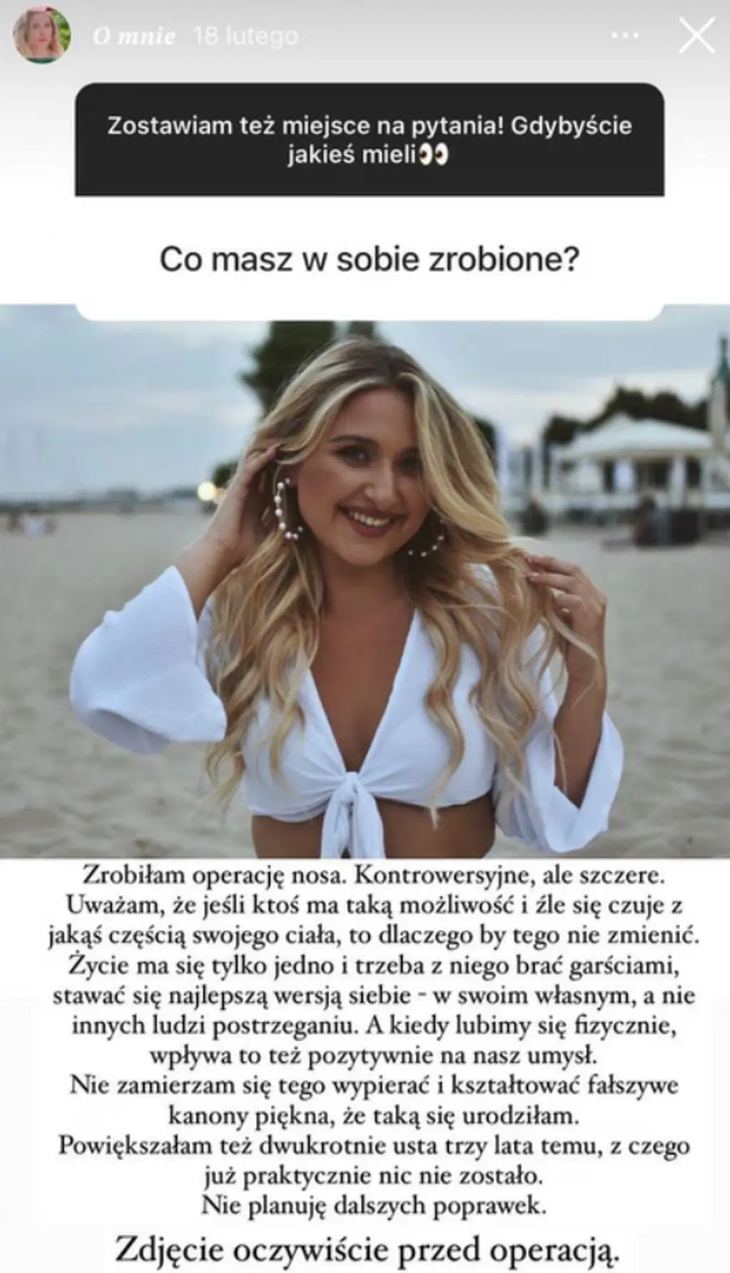 Luiza Krefft z "Hotelu Paradise" przeszła operację nosa