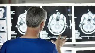 Diagnoza kilka lat wcześniej niż objawy. Przełomowe odkrycie badaczy dotyczące choroby Alzheimera