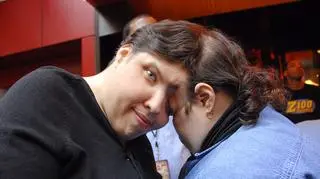 Nie żyje najstarsza para bliźniąt syjamskich na świecie