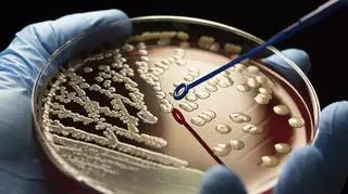 Przełomowe odkrycie dotyczące walki z rakiem. "Jesteśmy podekscytowani"