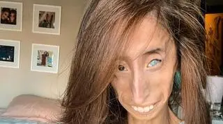 Lizzie Velasquez