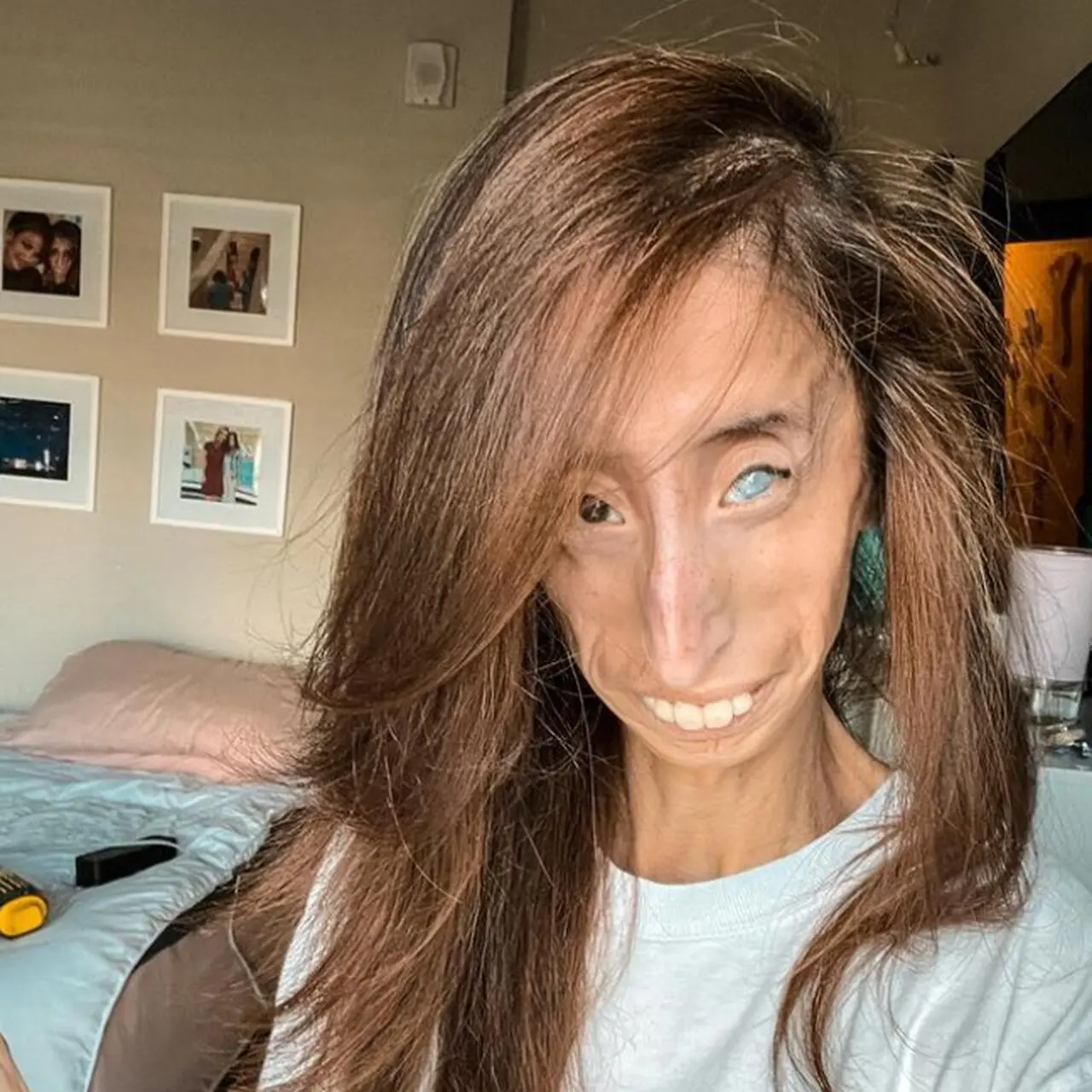 Najbrzydsza kobieta na świecie. Kim jest Lizzie Velasquez? - Dzień Dobry TVN