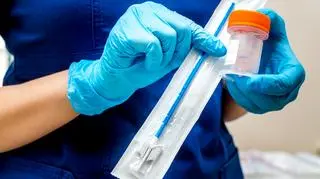 Płynna cytologia - co to za badanie i czym różni się od zwykłej cytologii? 