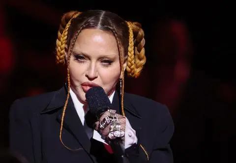 Madonna odniosła się do komentarzy dotyczących jej wyglądu. "Zeszła mi opuchlizna po operacji"