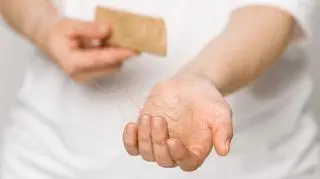 Łysienie to choroba. "Mała rewolucja w leczeniu" 