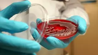Czy superbakterie można pokonać? "Zagrożenie dla zdrowia ludzi na całym świecie"