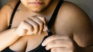 28-latka cierpiała z powodu biustu, który ważył 16 kg. Pokazała efekt operacji