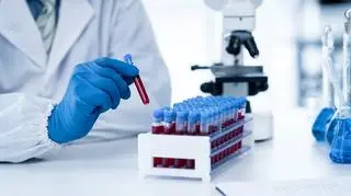 Anemia sierpowata - co to za choroba i jak się objawia? Jest "jedną z najważniejszych chorób genetycznych na świecie"