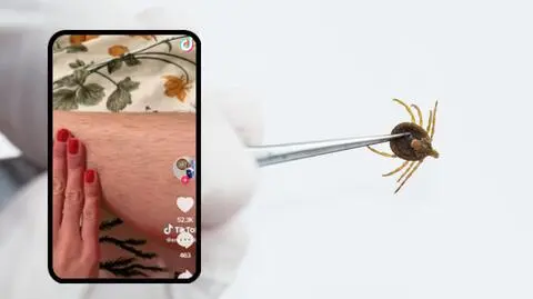 Tiktokerka zauważyła kleszcza dzięki owłosieniu na nogach