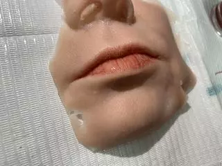 Epiteza twarzy 