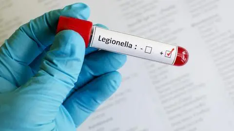 Legionella dotarła do kolejnych województw