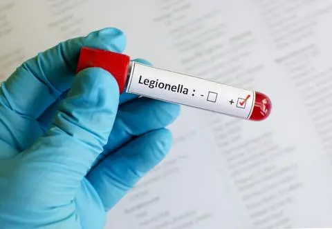 Legionella dotarła do kolejnych województw. "Osoby te zostały przyjęte kilka dni temu"