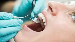 Lakierowanie zębów u dzieci i dorosłych – profilaktyka przeciwpróchnicza. Na czym polega?