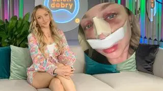 Kornelia z "Hotelu Paradise" przeszła operację nosa [TYLKO U NAS]