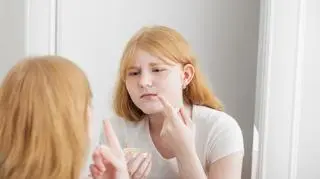 Specjalistyczne i domowe sposoby leczenia trądziku młodzieńczego. Co można zrobić, aby się go pozbyć?