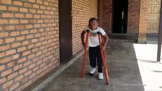 11-latek z Afryki zrobił pierwszy krok dzięki polskim lekarzom. "On uczy się dopiero chodzić"