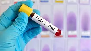 Test na cholesterol