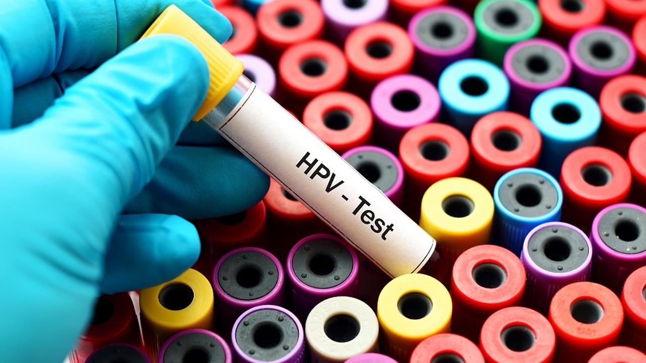 Test HPV