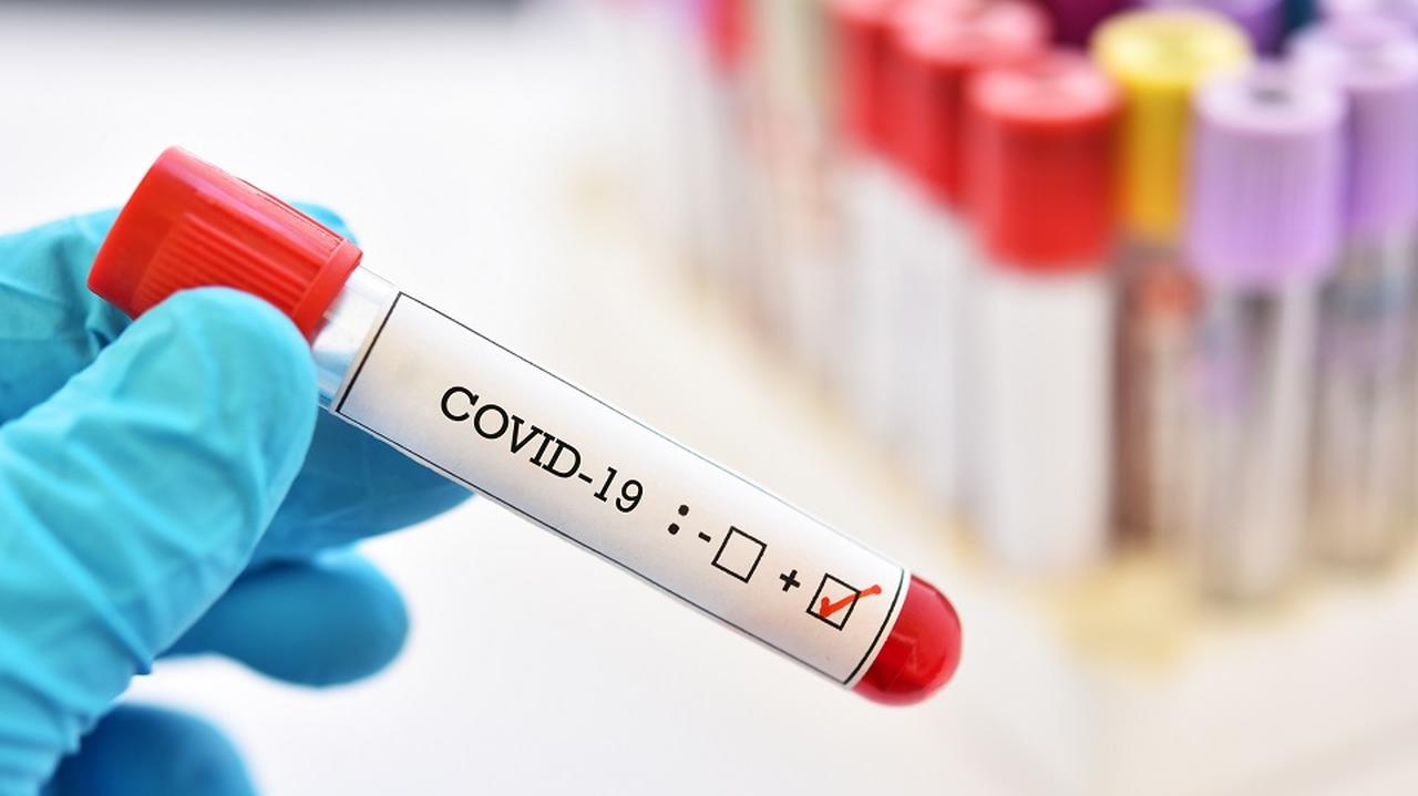 Test na koronawirusa