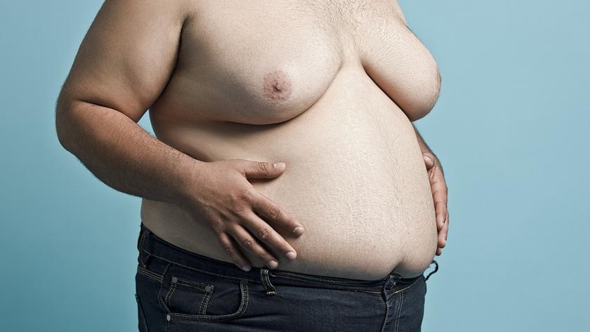 Mężczyzna z ginekomastią