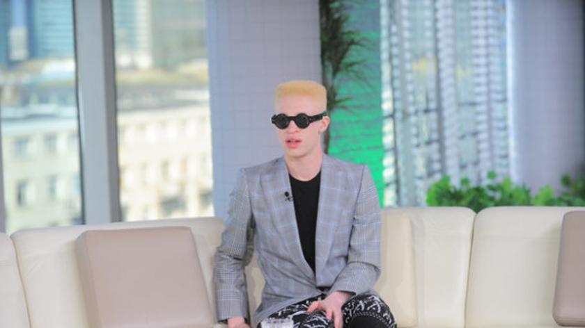 Albinos rozchwytywanym modelem 