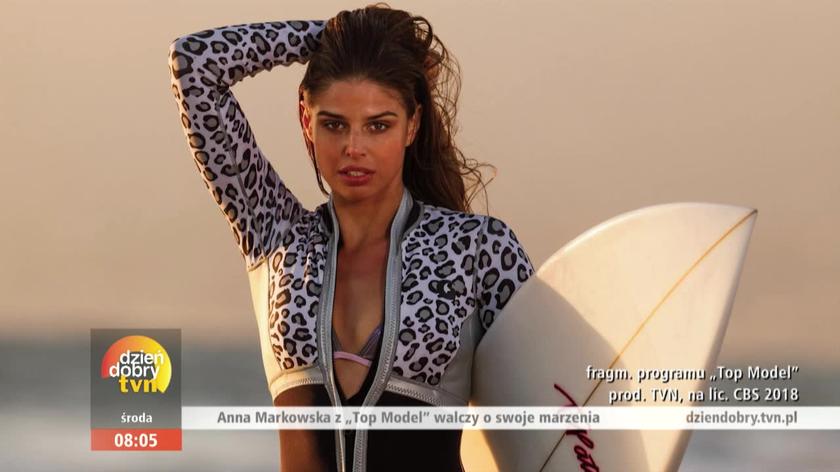 Anna Markowska z Top Model miała raka. Miała częściowo sparaliżowaną twarz