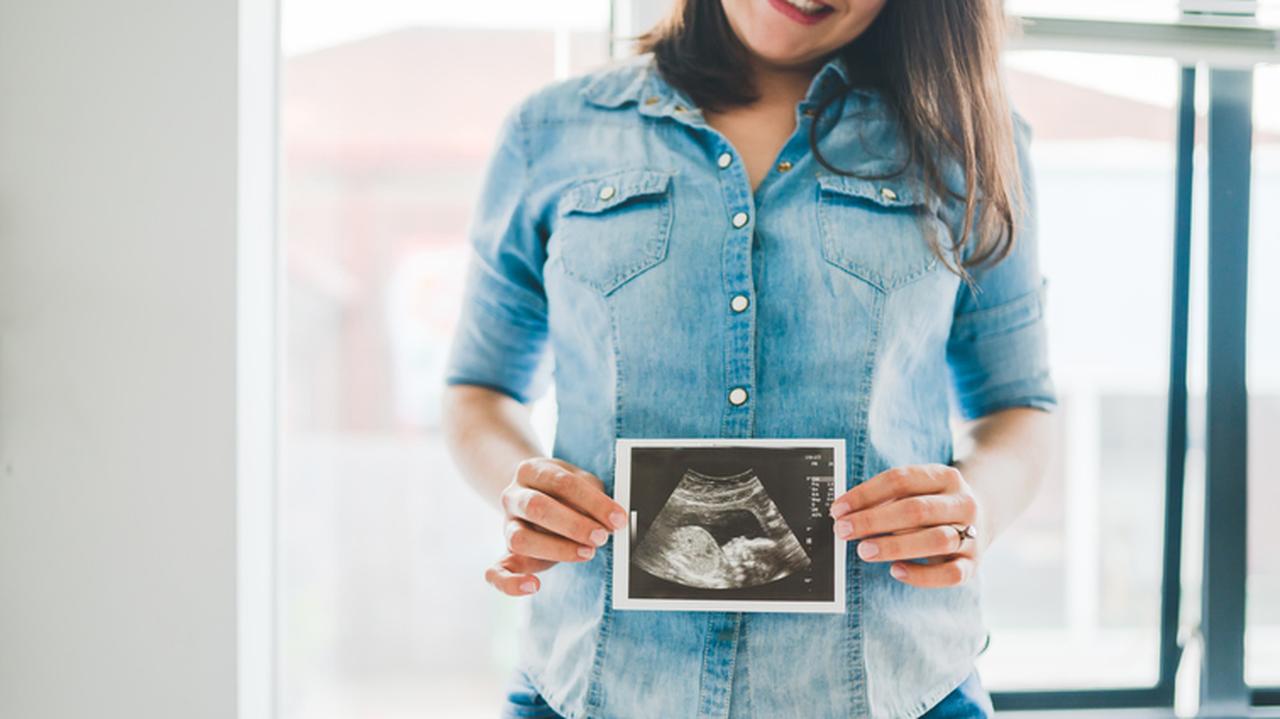 Kobieta w ciąży trzyma przed swoim brzuchem zdjęcie USG dziecka