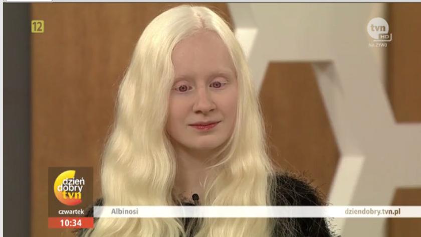 Albinosi w Rozmowach w Toku