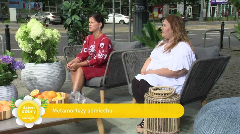 Metamorfoza uśmiechu Luizy