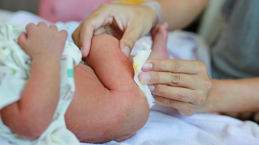 Biegunka u niemowlaka - mama przewija dziecko. Zmiana pieluchy.