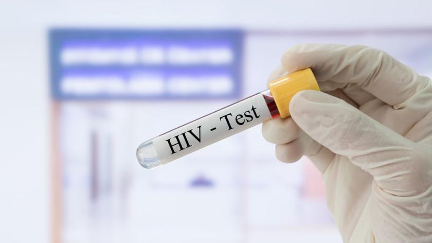 HIV, test 