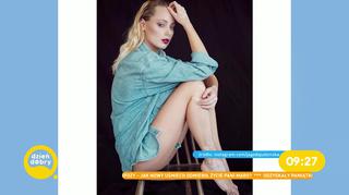 Polska modelka z bielactwem podbija świat mody