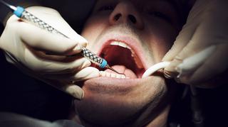 Co oznacza w senniku dentysta?