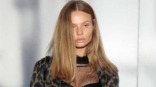 Modelka Magdalena Frąckowiak przeszła bardzo poważną operację