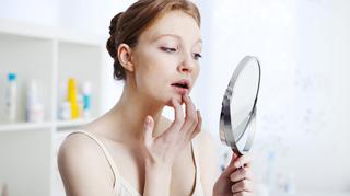 Od czego robi się opryszczka na ustach? Przyczyny, objawy i leczenie