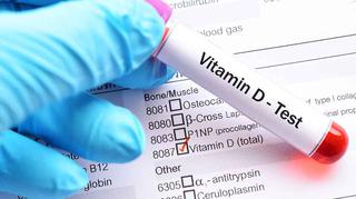 Większość pacjentów z COVID-19 może mieć niedobór witaminy D