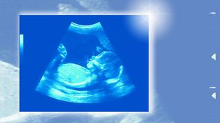 20. tydzień ciąży - waga dziecka i jego wygląd w połowie ciąży