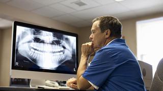 Niemycie zębów może zwiększać ryzyko zachorowania na raka? 