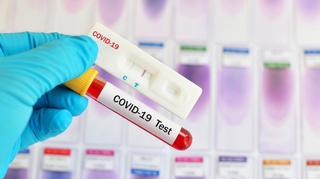 Kolejne dyskonty i sieci handlowe chcą wprowadzić do sprzedaży testy na koronawirusa