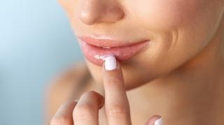 Skuteczny sposób na spierzchnięte usta. Jakie są przyczyny pierzchnięcia ust?