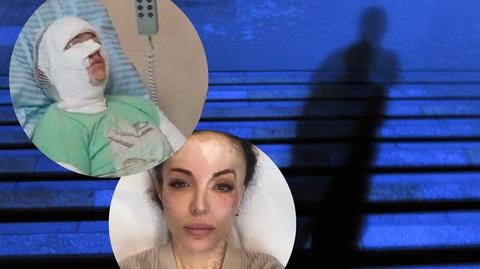 Katarzyna Dacyszyn wspomina koszmar sprzed lat. Jak teraz wygląda?