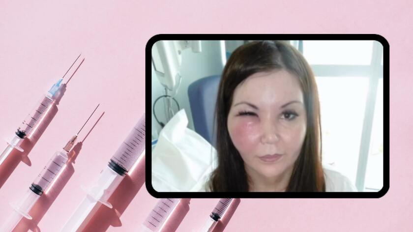 Strzykawki z płynem, Giuseppina Baccarella