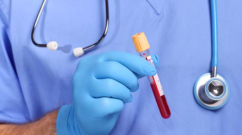 Zmutowany szczep wirusa HIV